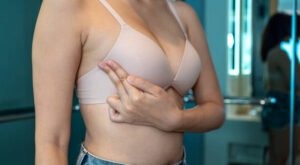 How Does Breast Reduction Surgery Affect Breastfeeding?