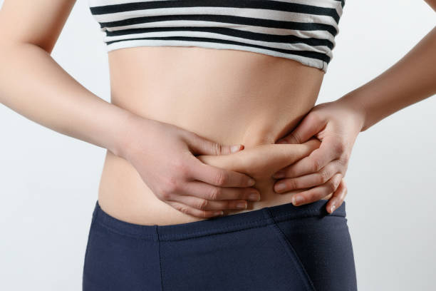 Is it Normal to Gain Weight After Tummy Tuck Surgery?