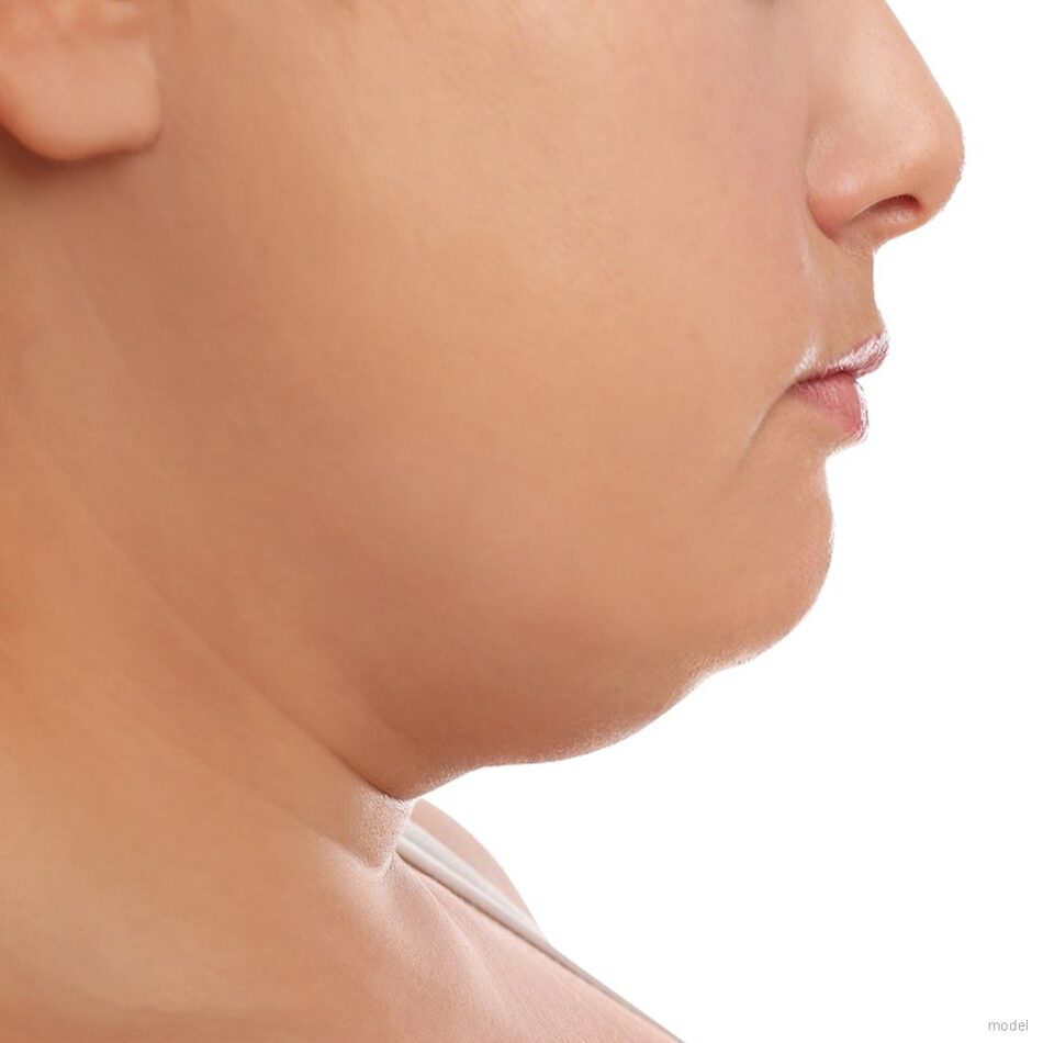 How Double Chin Removal Gives You Quick Relief from a Heavy Jawline