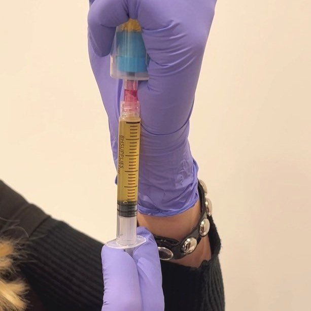 Discover the Best Treatments for Your Skin in Chicago at Opulence Chicago LLC