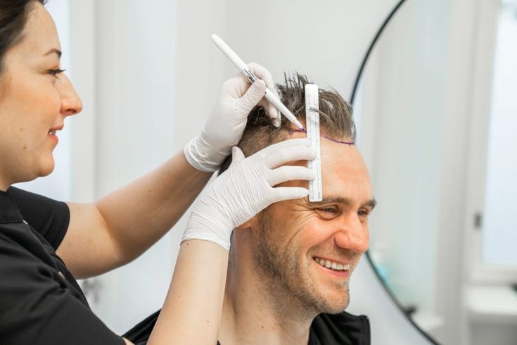 How to Choose the Best Hair Transplant for Safe and Lasting Growth