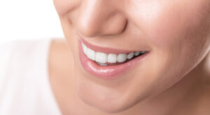 Are E-Max Veneers Good for Thin Enamel Issues?