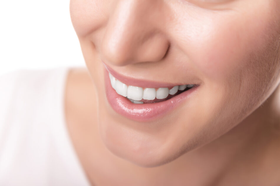 Are E-Max Veneers Good for Thin Enamel Issues?