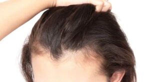 Are custom hair-growth serums in Dubai better than over-the-counter products?