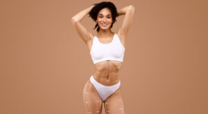 Why Choosing the Best Fat Transfer Surgeons in Dubai Ensures Long-Lasting Fat Survival