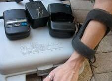 How a Bone Growth Stimulator Specialist Helps Speed Up Fracture Healing