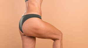 Brazilian Butt Lift Dubai for Natural Curves