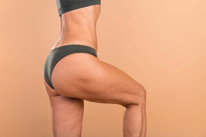 Brazilian Butt Lift Dubai for Natural Curves