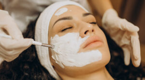 How to Understand Chemical Peels Cost for Safe and Radiant Skin
