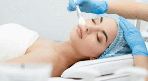 Chemical peels in Dubai: Step-by-Step Guide for First-Time Users