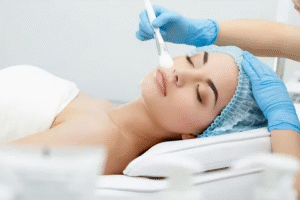 Chemical peels in Dubai: Step-by-Step Guide for First-Time Users
