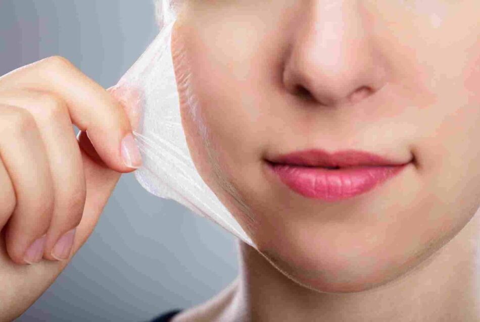 Chemical Peels Cost Guide for Safe Skin Renewal and Fast Results