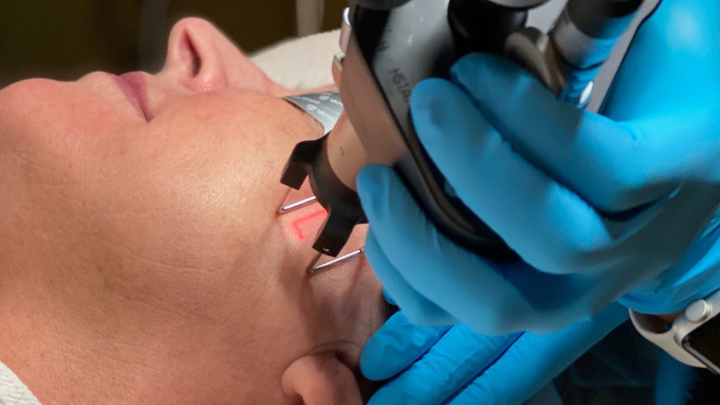 Picosure Laser Treatment Dubai