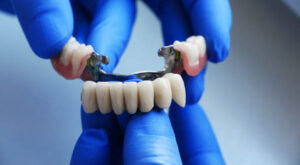 How to Extend the Life of Dental Crowns and Bridges