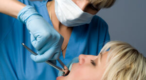 Tooth Extraction Cost for Crowded Teeth Removal
