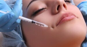 The Cost of Dermal Fillers in Dubai: What Influences the Price?