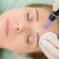 Dermapen Treatment Dubai for Non-Invasive Renewal