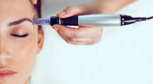 Dermapen Treatment Dubai for Skin Freshness Boost