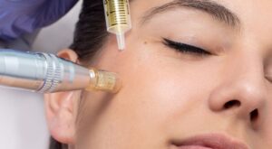 Exosome Therapy for Scar and Pigmentation Repair