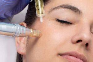 Exosome Therapy for Scar and Pigmentation Repair