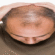 Hair Transplant in Abu Dhabi: Real Stories, Real Transformations