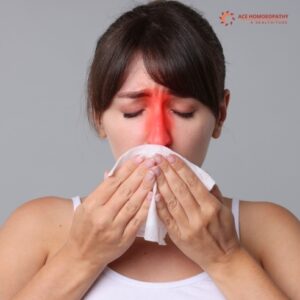 Homeopathy for Sinusitis: A Natural Path to Long-Lasting Relief