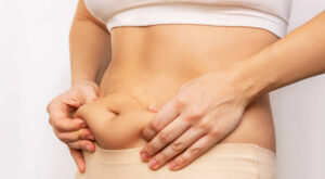 How Circumferential Abdominoplasty Enhances Mobility ?