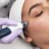 How Radiofrequency Treatments Improve Skin Elasticity ?