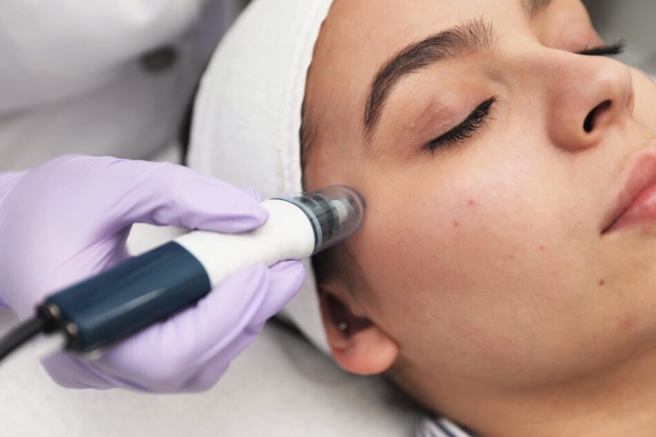How Radiofrequency Treatments Improve Skin Elasticity ?