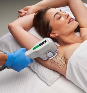 Hyperhidrosis Treatment Options Tailored to You