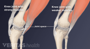 Everyday Ways to Strengthen and Protect Knee Health