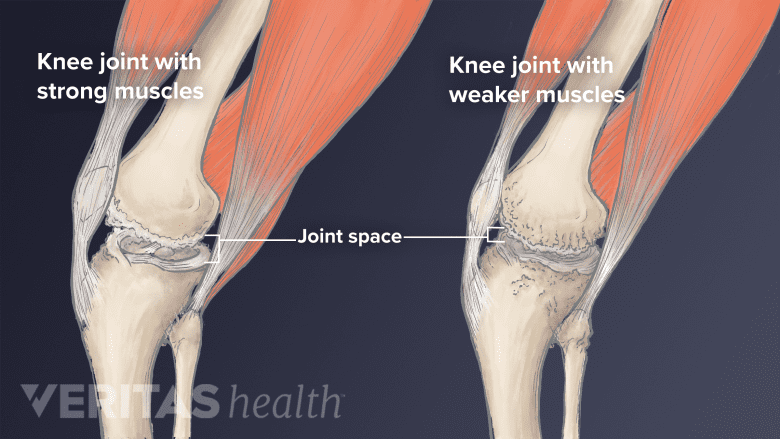 Everyday Ways to Strengthen and Protect Knee Health