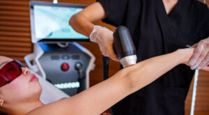 Laser Hair Removal for Stretch Mark Camouflage