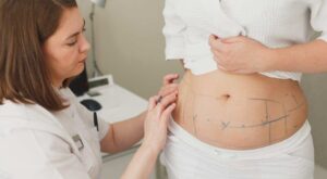 Nutrition Support for Laser Liposuction Recovery