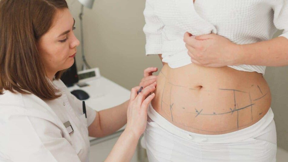 Nutrition Support for Laser Liposuction Recovery