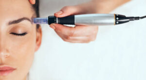 Mesotherapy in Dubai: Benefits for Skin Glow