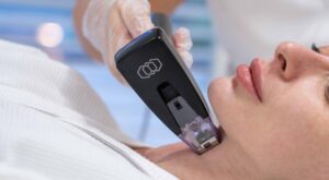 Morpheus8 for Chest and Décolletage: Treatment Insights