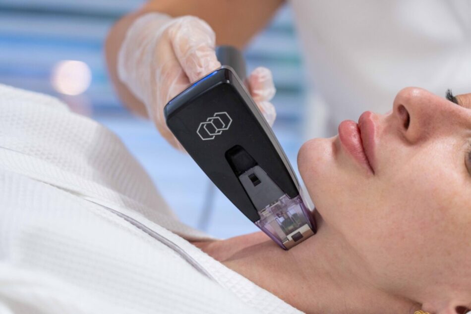 Morpheus8 for Chest and Décolletage: Treatment Insights