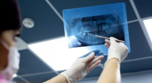 Panoramic Dental X-Ray Cost for Uninsured Patients