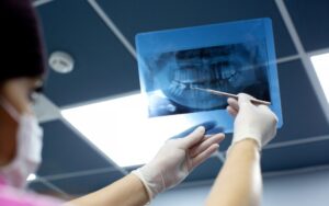 Panoramic Dental X-Ray Cost for Uninsured Patients