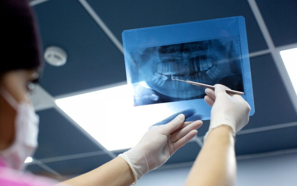 Panoramic Dental X-Ray Cost for Uninsured Patients