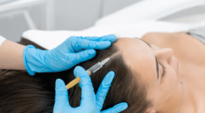 Best PRP Hair Treatment Techniques Used Today