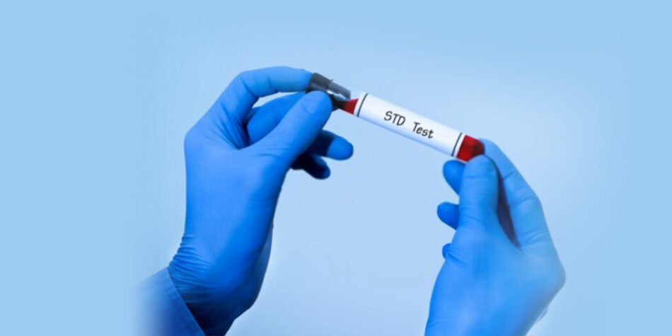 STD Test in Dubai: Guide for First-Time Visitors to a Sexual Health Clinic