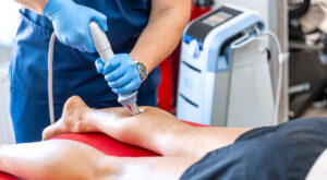 Smooth and Even Skin with Spider Vein Removal