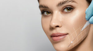 Achieve a Radiant, Youthful Look Effortlessly with Thread Lift