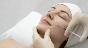 Transform Your Skin with PDRN Treatment