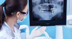Why Panoramic Dental X-Ray Cost Is a Smart Investment
