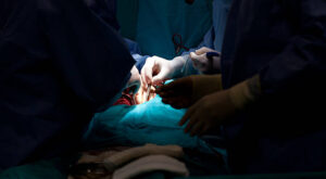 Dubai Vascular Surgery: Facts & Benefits