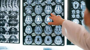 Looking for a Doctor Recommended PEMF System in MD?