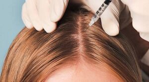 Why People Choose Hair Fillers Treatment Over Other Options ?
